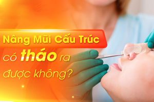 Tại sao nâng mũi cấu trúc có tháo ra được không được quan tâm?