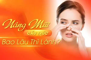 Nâng mũi cấu trúc bao lâu lành và đẹp? Các yếu tố tác động?