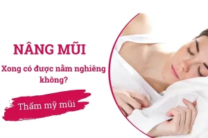Nâng mũi bao lâu thì được nằm nghiêng? Lời khuyên của bác sĩ