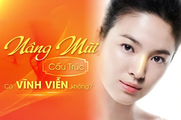 Nâng mũi cấu trúc có được vĩnh viễn không, được cả đời không