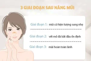 Nâng mũi bao lâu được dưỡng da, bôi kem chống nắng, dùng sữa rửa mặt?