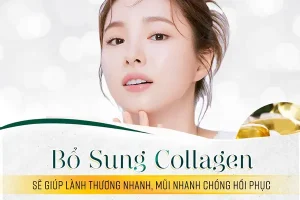 Nâng mũi có được uống collagen không?