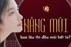 Nâng mũi bao lâu thì đầu mũi hết to - Chuyên gia giải đáp
