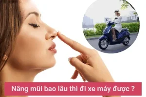 Nâng mũi bao lâu thì đi xe máy được, liệu có đi xe máy được không?