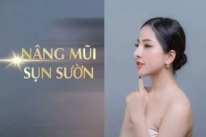Kinh nghiệm nâng mũi sụn sườn: 5 vấn đề cốt lõi quan trọng nhất