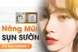 Nâng mũi sụn sườn có đau không? Lấy sụn sườn có đau không?