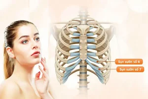 Sụn sườn có mọc lại không, lấy đi có ảnh hưởng đến sức khỏe?
